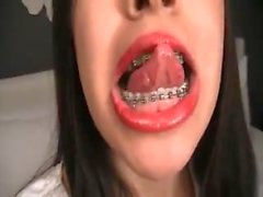 Brunnette big mouth & braces (vore)