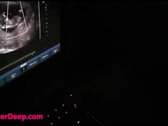 12 Weeks Pregnant Heather Deep Thai Teen gets facial after ultrasound