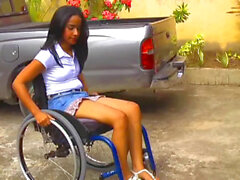 Amputee, mentally disabled girl