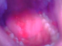 Gypsy Endoscopic View